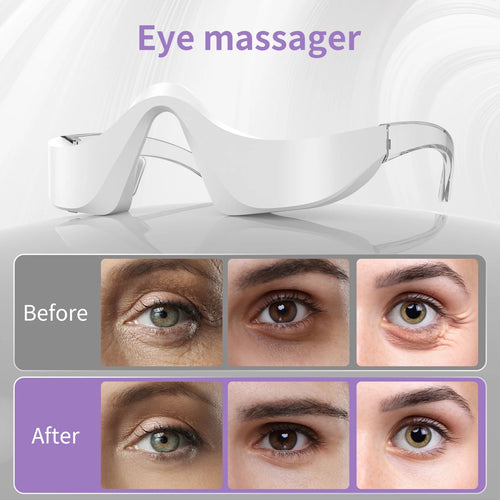 3-in-1 Eye Beauty Massager – EMS, Vibration & LED Light Therapy for Eye Fatigue Relief, Dark Circles & Anti-Aging Eye Care at Home - sensationmarketsensationmarket14:200002130;400079803:233130635593-in-1 Eye Beauty Massager – EMS, Vibration & LED Light Therapy for Eye Fatigue Relief, Dark Circles & Anti-Aging Eye Care at HomeUSB Type-CIvory