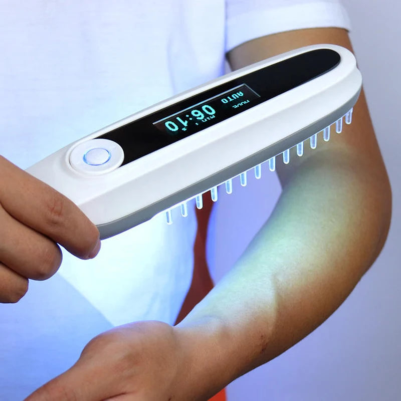 311nm UVB-Schmalband-Phototherapie-Lampe – UV-Licht-Behandlungsgerät für Vitiligo, Psoriasis & Ekzeme