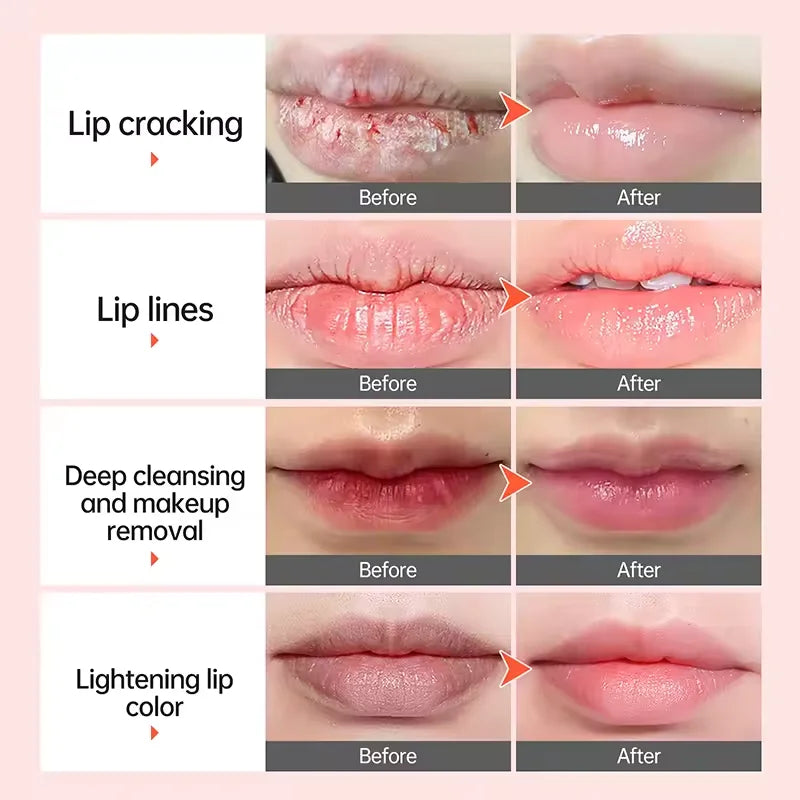 Sérum aclarante para labios: bálsamo y aceite iluminador para labios oscuros y de fumador, tratamiento hidratante de brillo labial