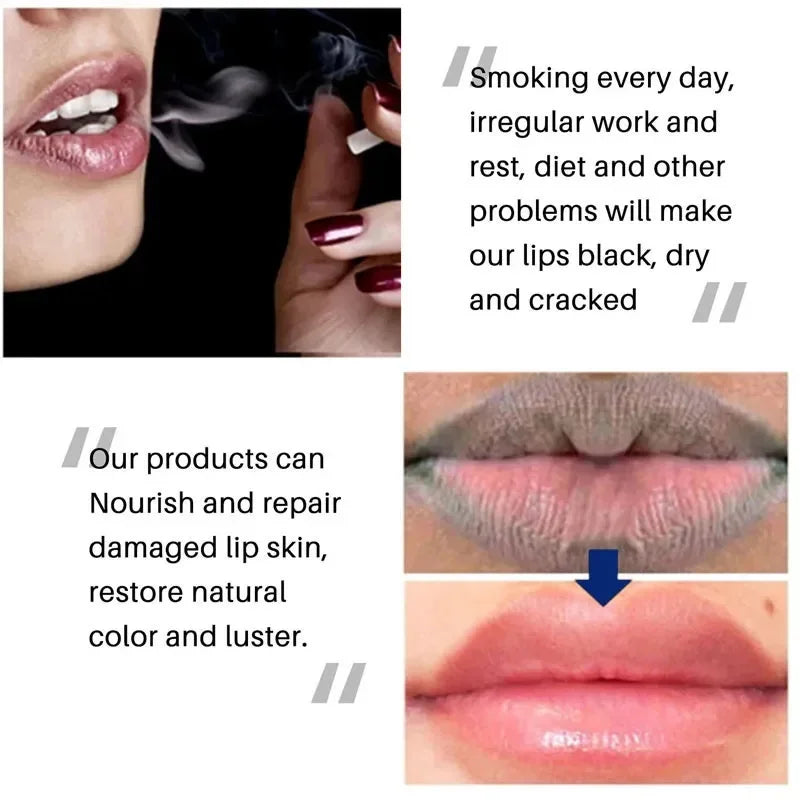Sérum aclarante para labios: bálsamo y aceite iluminador para labios oscuros y de fumador, tratamiento hidratante de brillo labial