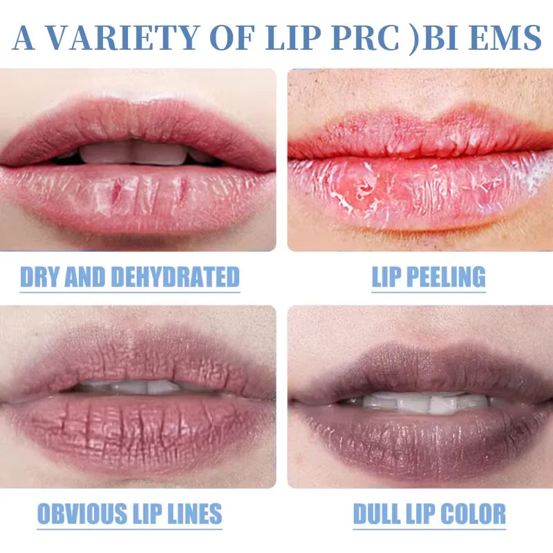 Sérum aclarante para labios: bálsamo y aceite iluminador para labios oscuros y de fumador, tratamiento hidratante de brillo labial
