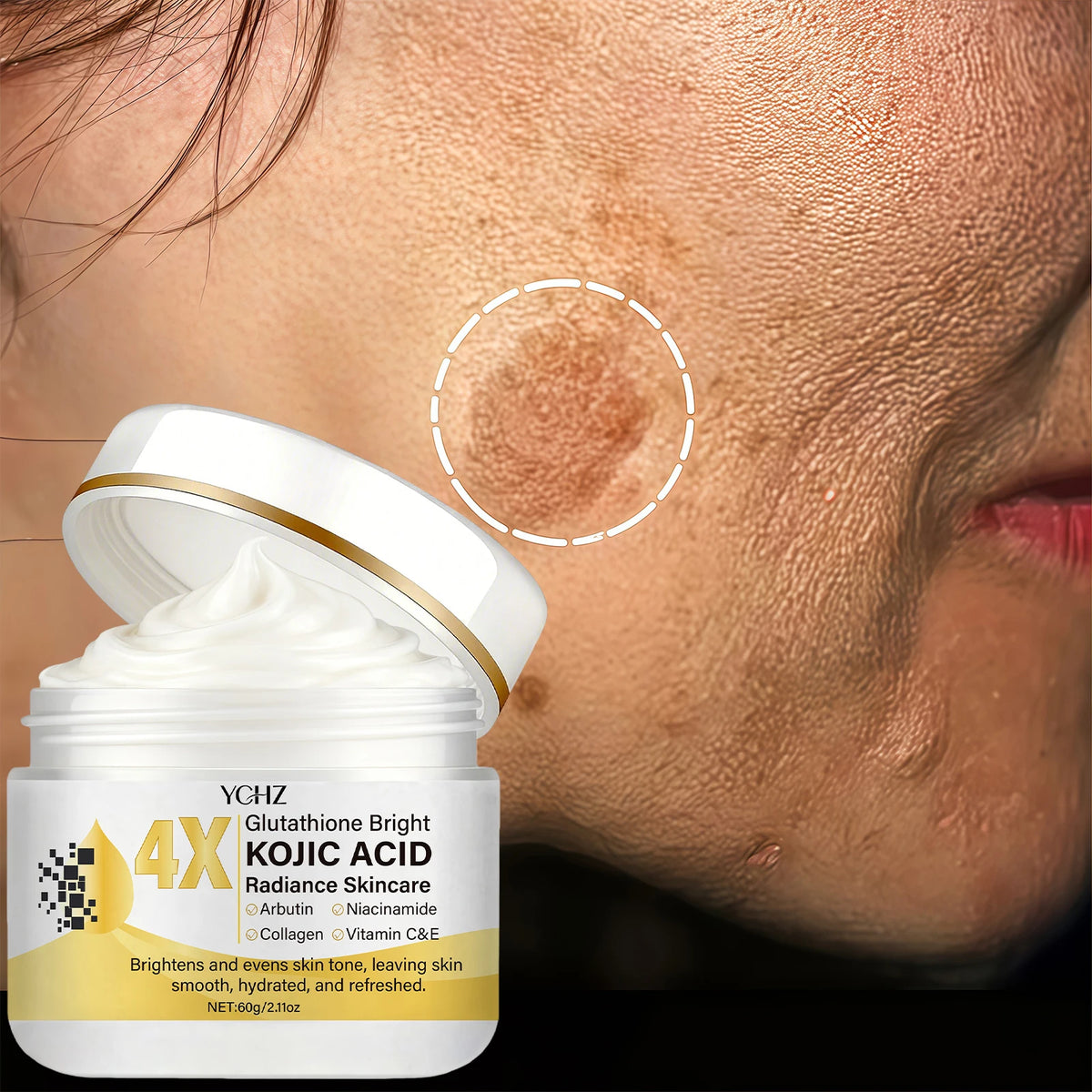 Crema facial de ácido kójico: Iluminadora, correctora de manchas oscuras e hidratante | Día y noche | 60 g