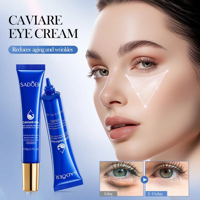 Caviar Eye Bag Removal Cream – Hyaluronic Acid Anti-Wrinkle Firming Eye Cream for Dark Circles, Puffiness & Fine Lines (20g) - sensationmarketsensationmarket14:10#1pc-20gCaviar Eye Bag Removal Cream – Hyaluronic Acid Anti-Wrinkle Firming Eye Cream for Dark Circles, Puffiness & Fine Lines (20g)1pc-20g