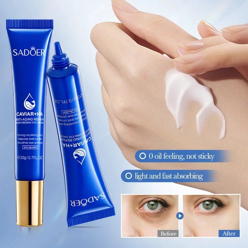 Caviar Eye Bag Removal Cream – Hyaluronic Acid Anti-Wrinkle Firming Eye Cream for Dark Circles, Puffiness & Fine Lines (20g) - sensationmarketsensationmarket14:10#1pc-20gCaviar Eye Bag Removal Cream – Hyaluronic Acid Anti-Wrinkle Firming Eye Cream for Dark Circles, Puffiness & Fine Lines (20g)1pc-20g