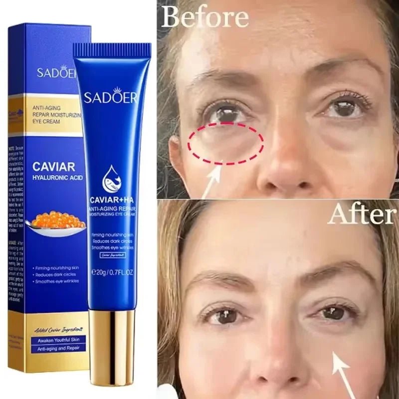 Caviar Eye Bag Removal Cream – Hyaluronic Acid Anti-Wrinkle Firming Eye Cream for Dark Circles, Puffiness & Fine Lines (20g) - sensationmarketsensationmarket14:10#1pc-20gCaviar Eye Bag Removal Cream – Hyaluronic Acid Anti-Wrinkle Firming Eye Cream for Dark Circles, Puffiness & Fine Lines (20g)1pc-20g