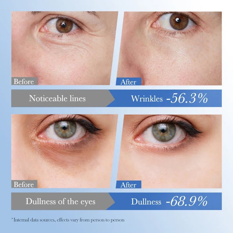 Caviar Eye Bag Removal Cream – Hyaluronic Acid Anti-Wrinkle Firming Eye Cream for Dark Circles, Puffiness & Fine Lines (20g) - sensationmarketsensationmarket14:10#1pc-20gCaviar Eye Bag Removal Cream – Hyaluronic Acid Anti-Wrinkle Firming Eye Cream for Dark Circles, Puffiness & Fine Lines (20g)1pc-20g