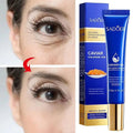 Caviar Eye Bag Removal Cream – Hyaluronic Acid Anti-Wrinkle Firming Eye Cream for Dark Circles, Puffiness & Fine Lines (20g) - sensationmarketsensationmarket14:10#1pc-20gCaviar Eye Bag Removal Cream – Hyaluronic Acid Anti-Wrinkle Firming Eye Cream for Dark Circles, Puffiness & Fine Lines (20g)1pc-20g