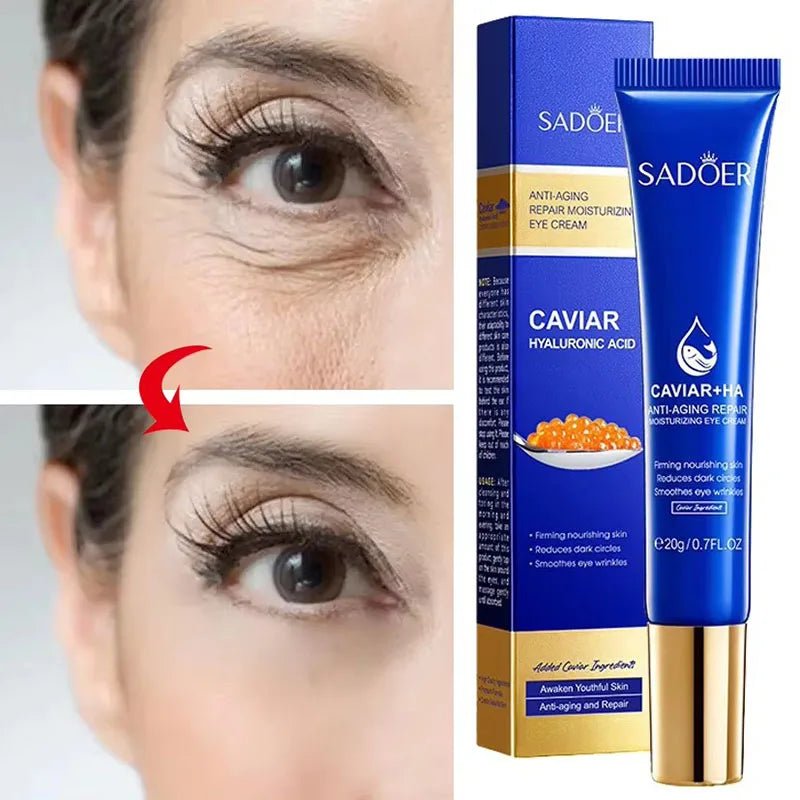 Caviar Eye Bag Removal Cream – Hyaluronic Acid Anti-Wrinkle Firming Eye Cream for Dark Circles, Puffiness & Fine Lines (20g) - sensationmarketsensationmarket14:10#1pc-20gCaviar Eye Bag Removal Cream – Hyaluronic Acid Anti-Wrinkle Firming Eye Cream for Dark Circles, Puffiness & Fine Lines (20g)1pc-20g