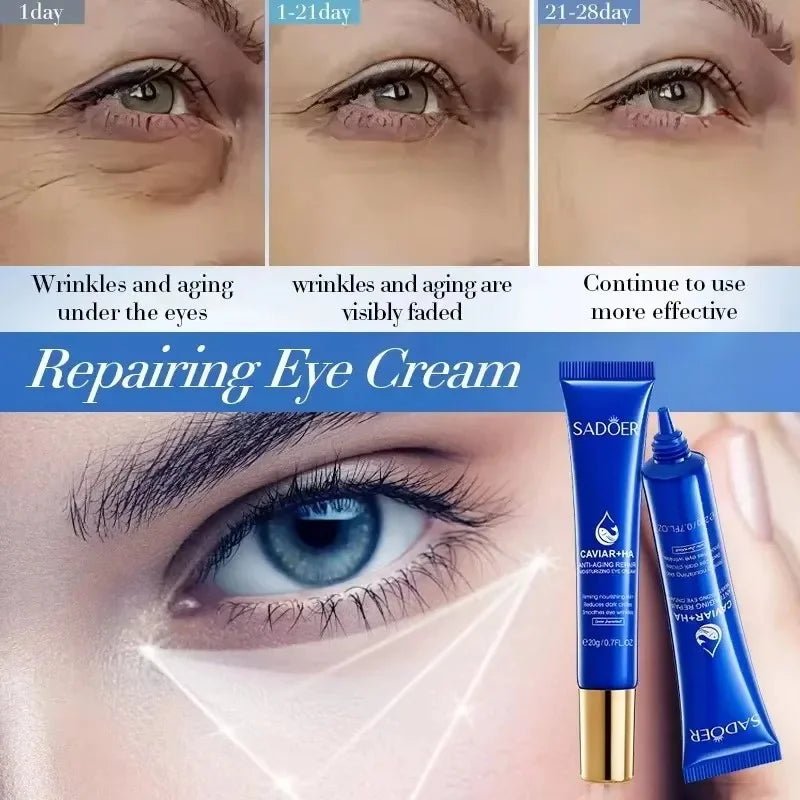 Caviar Eye Bag Removal Cream – Hyaluronic Acid Anti-Wrinkle Firming Eye Cream for Dark Circles, Puffiness & Fine Lines (20g) - sensationmarketsensationmarket14:10#1pc-20gCaviar Eye Bag Removal Cream – Hyaluronic Acid Anti-Wrinkle Firming Eye Cream for Dark Circles, Puffiness & Fine Lines (20g)1pc-20g