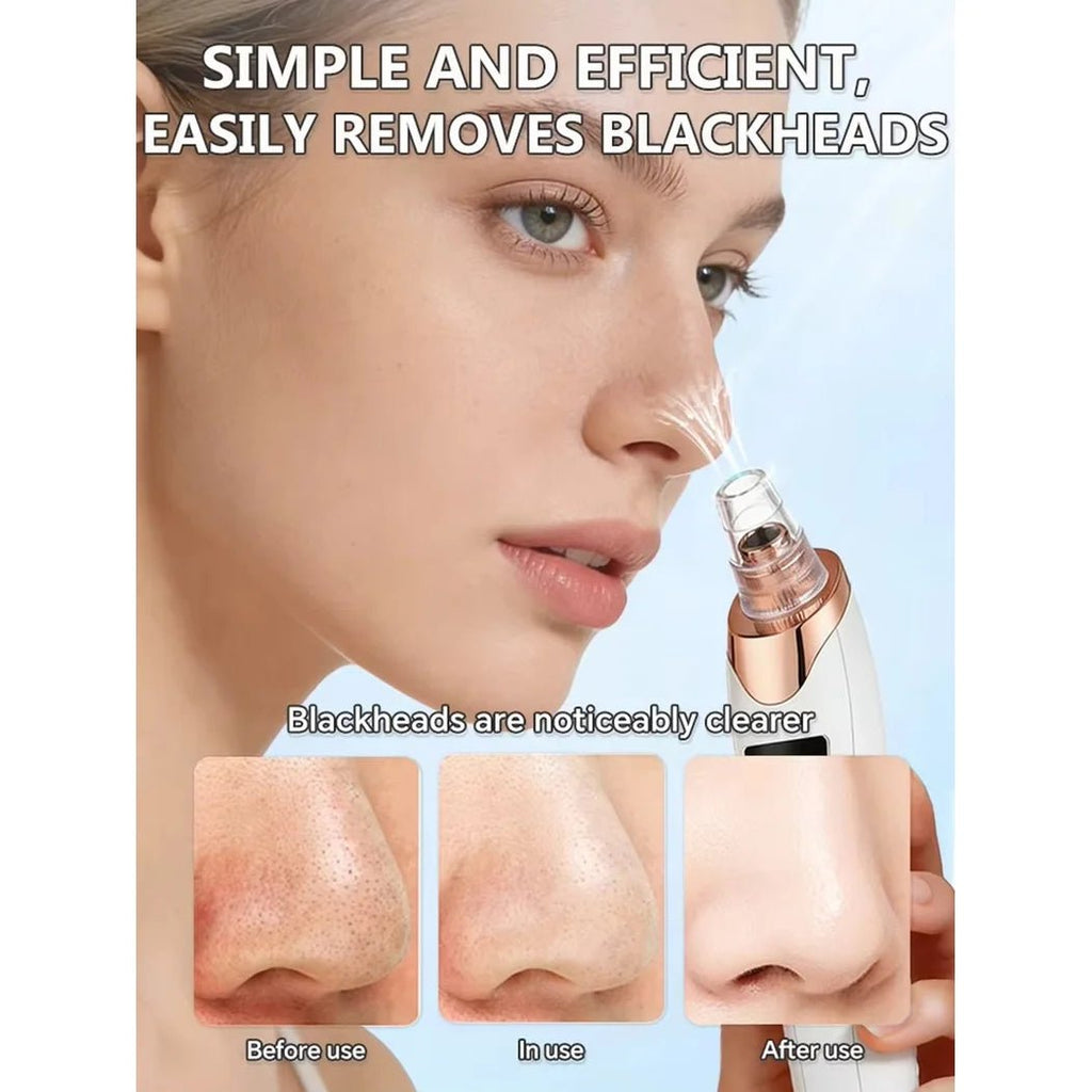 Electric Pore Vacuum Blackhead Remover – Professional Facial Pore Extractor & Skin Suction Machine for Deep Cleansing & Clear Skin - sensationmarketsensationmarket14:193#blackhead removerElectric Pore Vacuum Blackhead Remover – Professional Facial Pore Extractor & Skin Suction Machine for Deep Cleansing & Clear Skinblackhead remover
