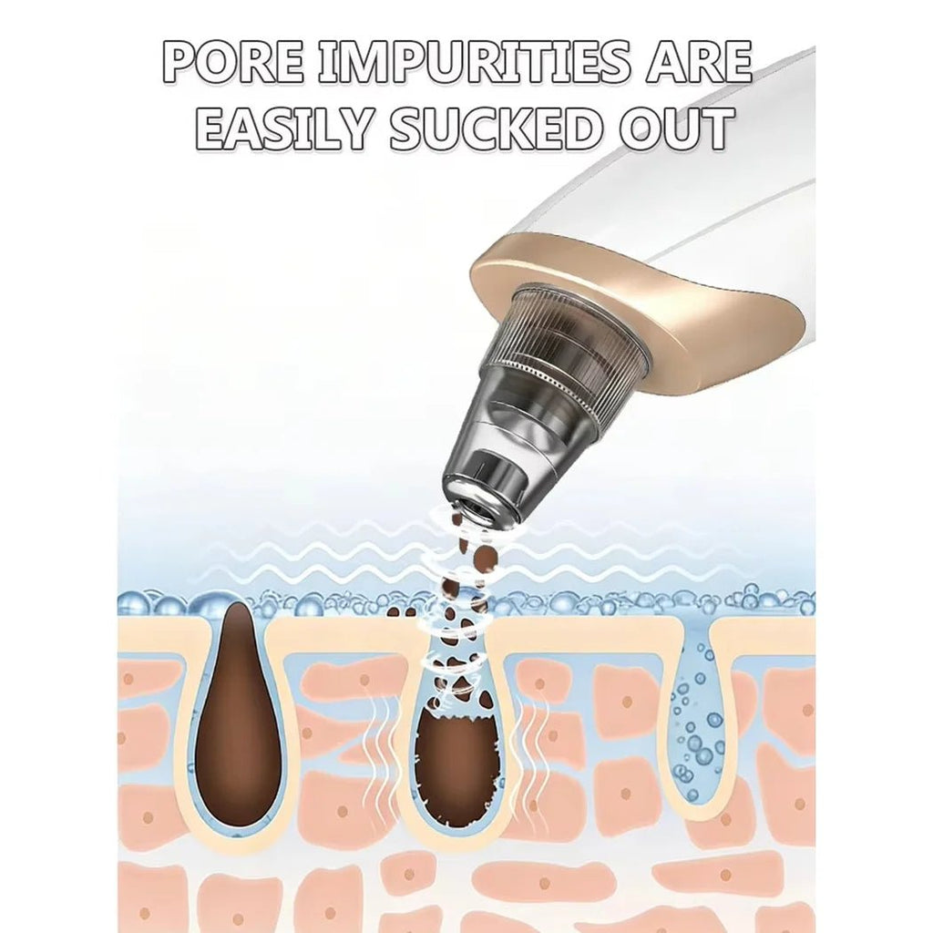 Electric Pore Vacuum Blackhead Remover – Professional Facial Pore Extractor & Skin Suction Machine for Deep Cleansing & Clear Skin - sensationmarketsensationmarket14:193#blackhead removerElectric Pore Vacuum Blackhead Remover – Professional Facial Pore Extractor & Skin Suction Machine for Deep Cleansing & Clear Skinblackhead remover
