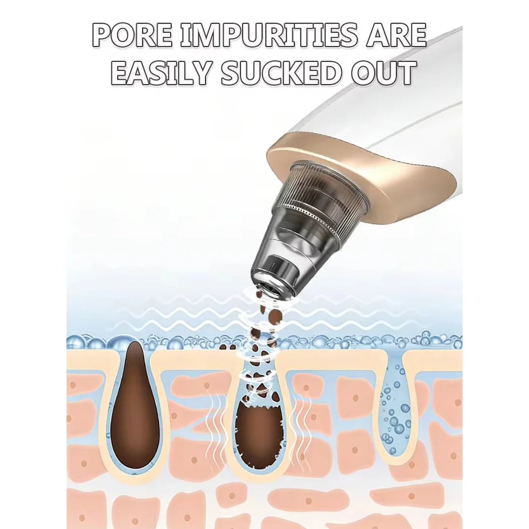 Electric Pore Vacuum Blackhead Remover – Professional Facial Pore Extractor & Skin Suction Machine for Deep Cleansing & Clear Skin - sensationmarketsensationmarket14:193#blackhead removerElectric Pore Vacuum Blackhead Remover – Professional Facial Pore Extractor & Skin Suction Machine for Deep Cleansing & Clear Skinblackhead remover