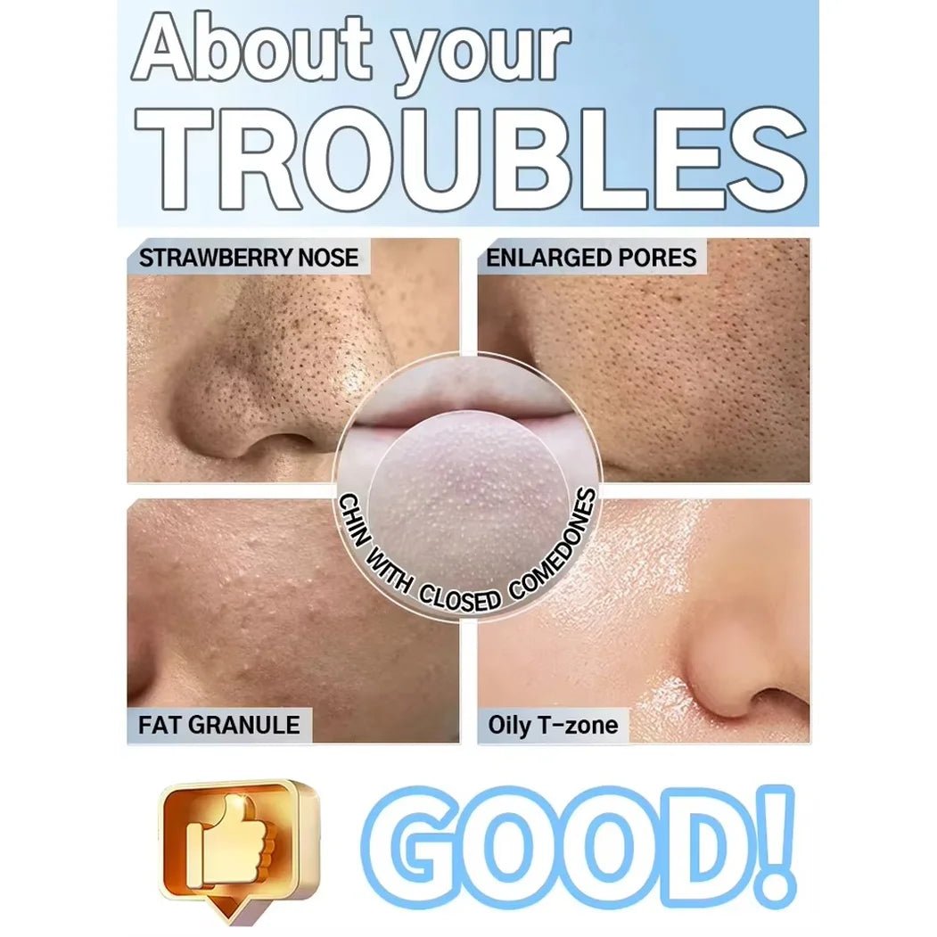 Electric Pore Vacuum Blackhead Remover – Professional Facial Pore Extractor & Skin Suction Machine for Deep Cleansing & Clear Skin - sensationmarketsensationmarket14:193#blackhead removerElectric Pore Vacuum Blackhead Remover – Professional Facial Pore Extractor & Skin Suction Machine for Deep Cleansing & Clear Skinblackhead remover