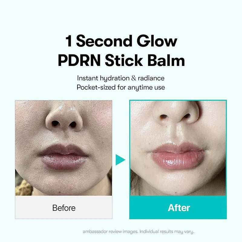 PDRN Collagen Essence Stick Balm – All-in-One Multi Wrinkle Treatment for Eyes, Neck & Face | Korean Glow Serum Moisturizer - sensationmarketsensationmarket200000581:200008193#Buy 2 Free 1PDRN Collagen Essence Stick Balm – All-in-One Multi Wrinkle Treatment for Eyes, Neck & Face | Korean Glow Serum MoisturizerBuy 2 Free 1